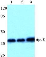 APOE Antibody in Western Blot (WB)