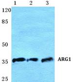 Arginase 1 Antibody in Western Blot (WB)