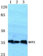 BST-2 Antibody in Western Blot (WB)