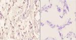 Menin Antibody in Immunohistochemistry (Paraffin) (IHC (P))