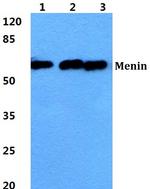 Menin Antibody in Western Blot (WB)