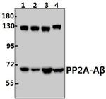 PPP2R1B Antibody in Western Blot (WB)