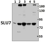 SLU7 Antibody in Western Blot (WB)