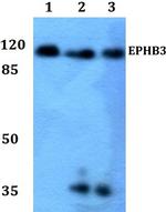 EphB3 Antibody in Western Blot (WB)