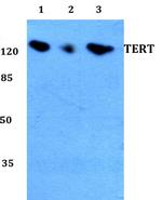 TERT Antibody in Western Blot (WB)