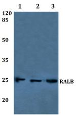 RALB Antibody in Western Blot (WB)