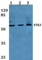 MST2 Antibody in Western Blot (WB)