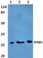 IFN beta Antibody in Western Blot (WB)