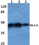 HLA-G Antibody in Western Blot (WB)