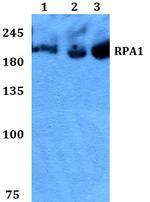 RPA70 Antibody in Western Blot (WB)