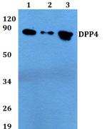 CD26 Antibody in Western Blot (WB)