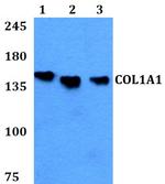 COL1A1 Antibody in Western Blot (WB)