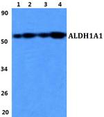 ALDH1A1 Antibody in Western Blot (WB)