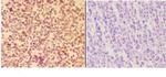 APAF1 Antibody in Immunohistochemistry (Paraffin) (IHC (P))