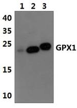 GPX1 Antibody in Western Blot (WB)