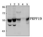 PRP19 Antibody in Western Blot (WB)