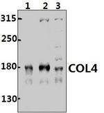 Collagen IV Antibody in Western Blot (WB)