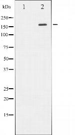 ROCK2 Antibody in Western Blot (WB)