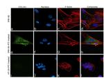 COL1A1 Antibody in Immunocytochemistry (ICC/IF)