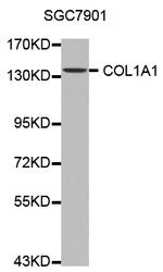 COL1A1 Antibody in Western Blot (WB)