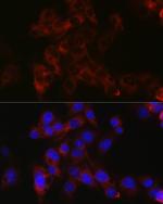 Apolipoprotein B Antibody in Immunocytochemistry (ICC/IF)