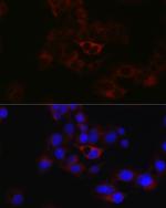 Apolipoprotein B Antibody in Immunocytochemistry (ICC/IF)