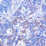 CD24 Antibody in Immunohistochemistry (Paraffin) (IHC (P))