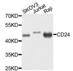 CD24 Antibody in Western Blot (WB)