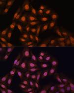 HP1 gamma Antibody in Immunocytochemistry (ICC/IF)