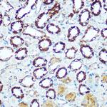 COX5B Antibody in Immunohistochemistry (Paraffin) (IHC (P))