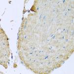 STING Antibody in Immunohistochemistry (Paraffin) (IHC (P))