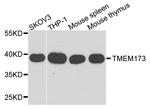 STING Antibody in Western Blot (WB)