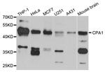 Carboxypeptidase A1 Antibody in Western Blot (WB)