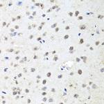 AGO2 Antibody in Immunohistochemistry (Paraffin) (IHC (P))