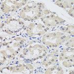 AGO2 Antibody in Immunohistochemistry (Paraffin) (IHC (P))