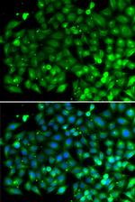 Bif1 Antibody in Immunocytochemistry (ICC/IF)