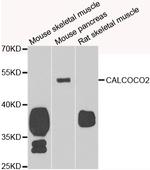 CALCOCO2 Antibody in Western Blot (WB)