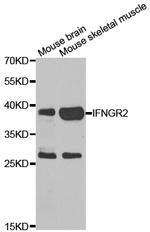 IFNGR2 Antibody in Western Blot (WB)