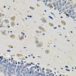 CD49b (Integrin alpha 2) Antibody in Immunohistochemistry (Paraffin) (IHC (P))