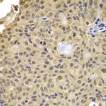 Cyclin A2 Antibody in Immunohistochemistry (Paraffin) (IHC (P))