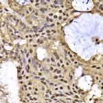 DRIL1 Antibody in Immunohistochemistry (Paraffin) (IHC (P))