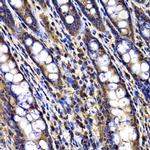 DRIL1 Antibody in Immunohistochemistry (Paraffin) (IHC (P))