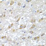 HSPA6 Antibody in Immunohistochemistry (Paraffin) (IHC (P))