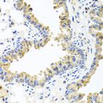 HSPA6 Antibody in Immunohistochemistry (Paraffin) (IHC (P))