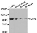 HSPA6 Antibody in Western Blot (WB)