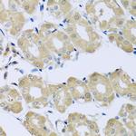 Synaptotagmin 4 Antibody in Immunohistochemistry (Paraffin) (IHC (P))