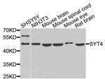 Synaptotagmin 4 Antibody in Western Blot (WB)