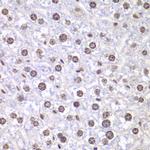 TOP1 Antibody in Immunohistochemistry (Paraffin) (IHC (P))