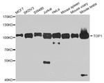 TOP1 Antibody in Western Blot (WB)