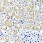 HARS2 Antibody in Immunohistochemistry (Paraffin) (IHC (P))